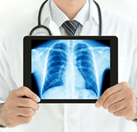 Digital X-ray Panel