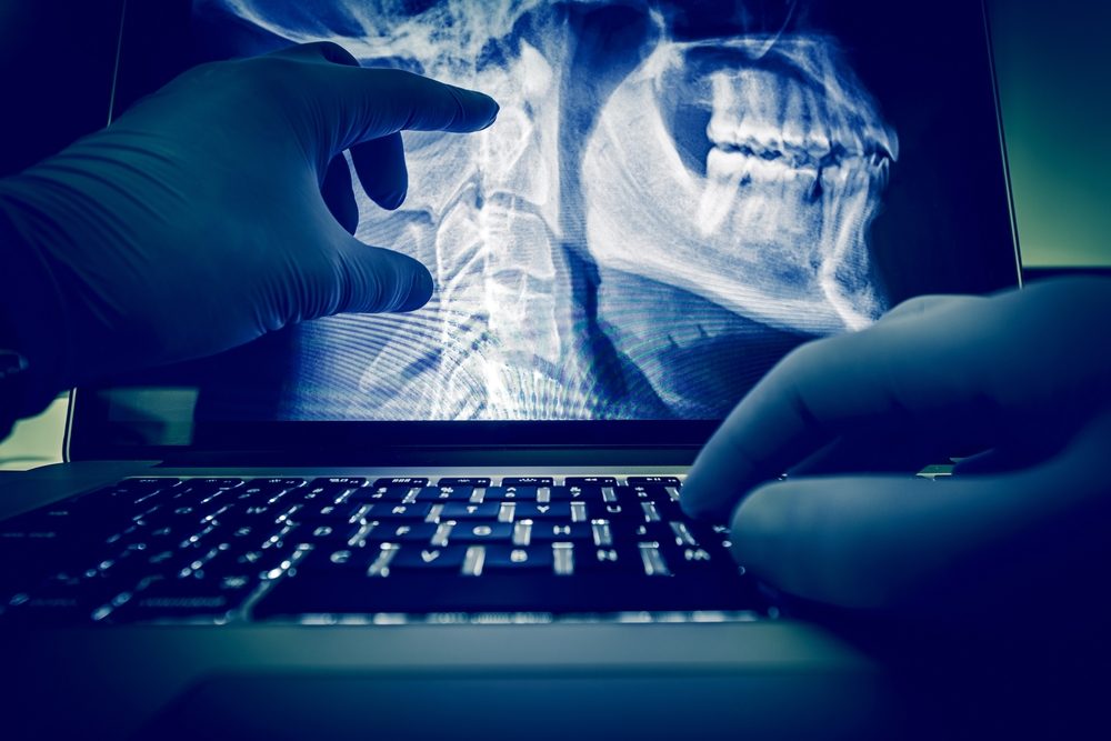 Why-Digital-X-Rays-Are-Better-Than-Traditional-X-Ray