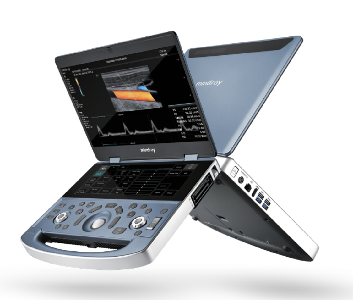 Unlocking the Full Potential of the Mindray MX7 with Advanced Software Upgrades