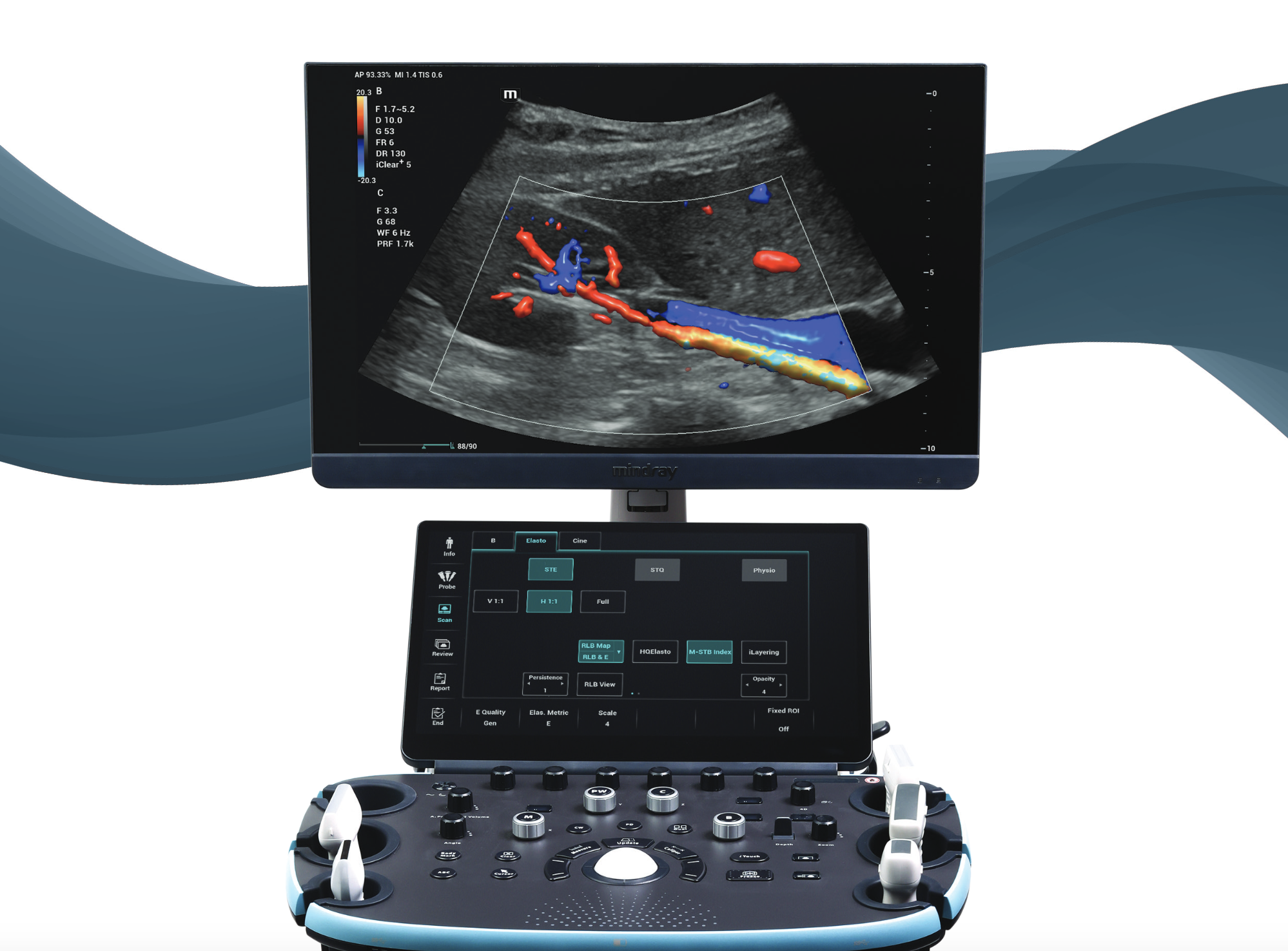 Why the Mindray Resona I9T is the Top Choice for Vascular Imaging