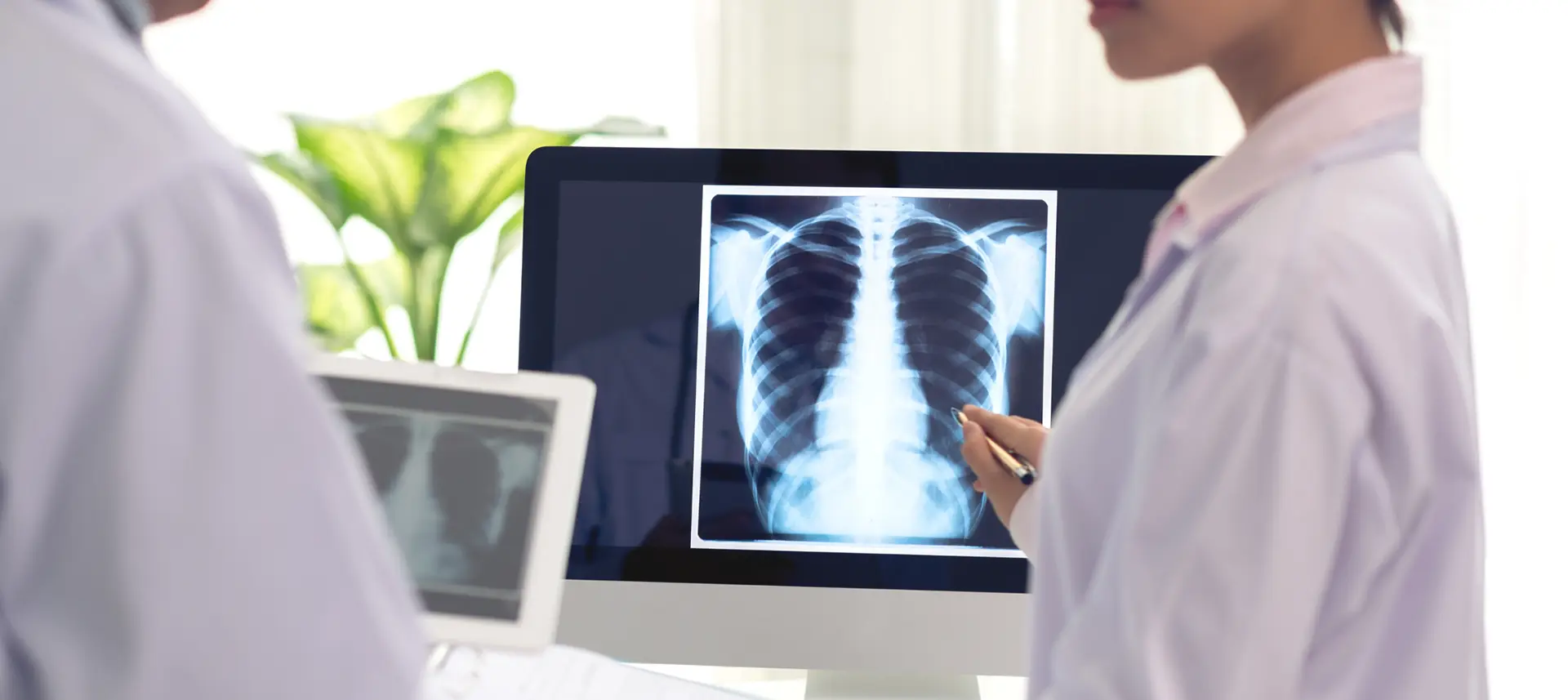 What Are the Different Types of XRay Machines?